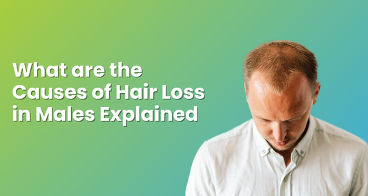 What are the Causes of Hair Loss in Males Explained