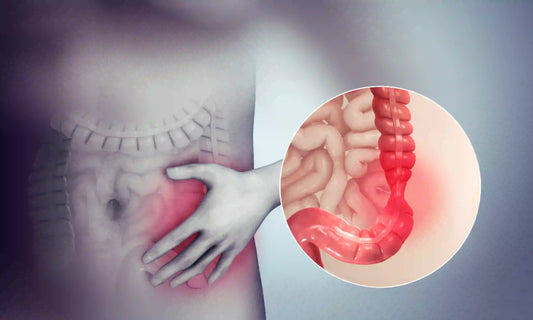 Colosturm for IBS Irritable Bowel Syndrome