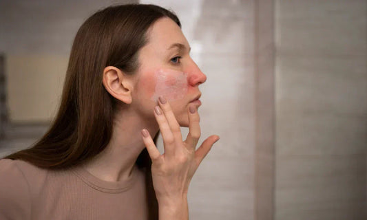 colostrum-for-burned-skin