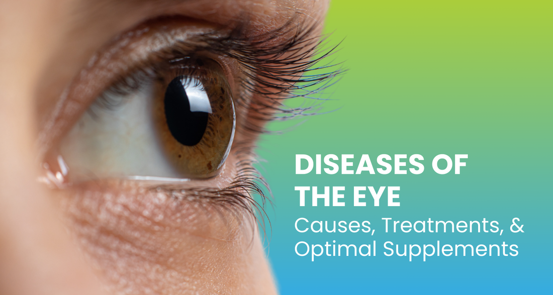Diseases of the Eye: Causes, Treatments, and Optimal Supplements