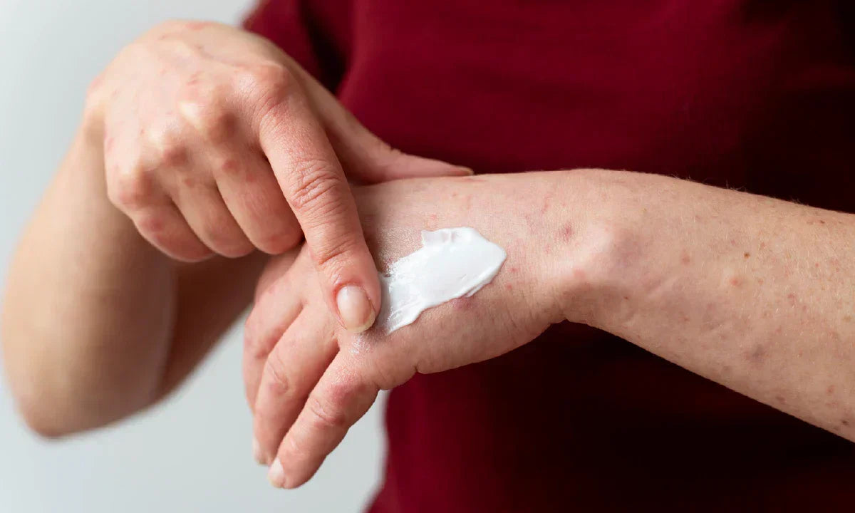 How Do You Get Super Glue Off Your Skin