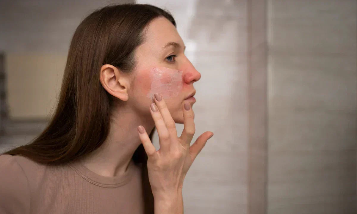 Is Colostrum Good for Burned Skin?