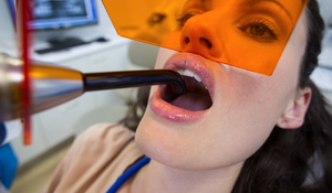 An Innovative Research: Hyaluronic Acid and Astaxanthin Gel Shows Anti-Inflammatory Promise for Diabetic Oral Ulcers