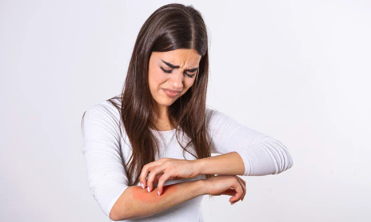 lyme-disease